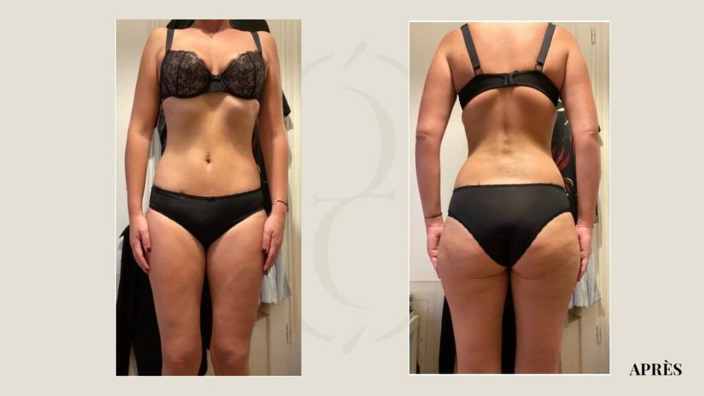 après résulats cocon infrarouges